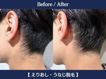 ランドマーク 中崎町(LANDMARK.)/《 襟足・うなじ 》