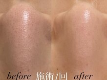 リスポアラボ(LIS PORE.LAB)/