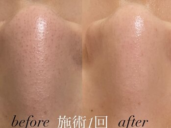 リスポアラボ(LIS PORE.LAB)/