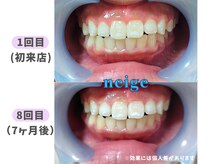 ネージュ(neige)/20代前半/女性