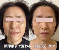 トリートメントルーム フェリーチェ(Felice)