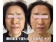 トリートメントルーム フェリーチェ(Felice)の写真