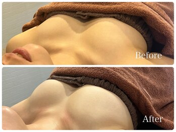 レクシートーキョー(LEXXXY TOKYO)/離れたバストも◎