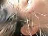 【究極小顔コース★】　ルート鬼美容鍼　60分　