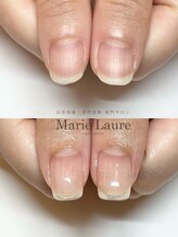 マリーロール 淀屋橋本店(Marie Laure)/自爪育成/深爪矯正/ネイルケア