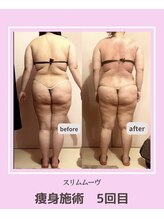 アコルデビューティー 恵比寿店(Acorde Beauty)/ビフォーアフター