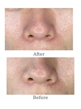 サロン リノ(salon rino)/ララピール