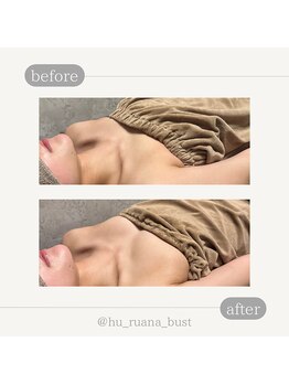 フルアナ(Hu ruana)/姿勢・巻き肩改善・バストケア