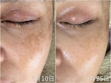 ウィル 二子新地(will)/艶玉肌ケア