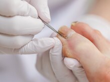 おん/爪ケアの流れ３