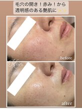 ケイン/お客様の変化♪