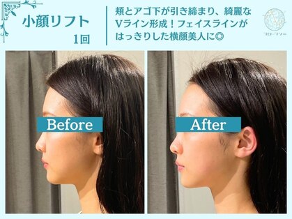 フローフシ∞の写真