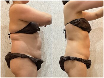 美容整体 ウェリナ 蟹江院/小顔矯正/骨盤矯正/美脚サロン