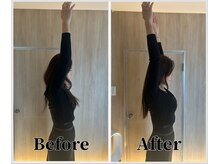 整体ラルース 中目黒(LALUZ)/40代　女性　猫背、巻き肩改善