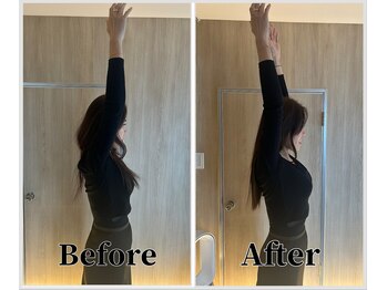 整体ラルース 中目黒(LALUZ)/40代 女性 猫背、巻き肩改善