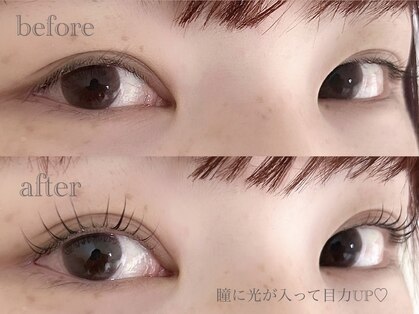 アミル(amiLe)の写真