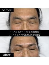 ユー 西船橋店(you)/ビフォーアフター写真
