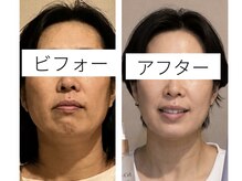 アロマリラクゼーションローザ(Roza)の雰囲気(背中から変える!バザルト背面+小顔矯正コース+ホームケア)