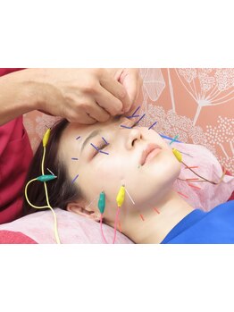 鍼灸施術を受けたい