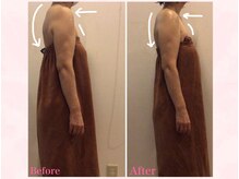 エステティックサロン サクラ(SAKURA)/肩/首こり解消◎猫背/巻肩に◎