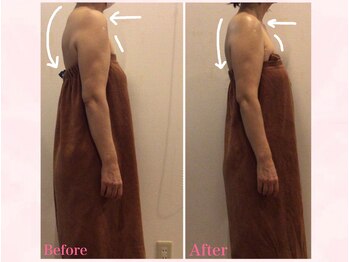 エステティックサロン サクラ(SAKURA)/肩/首こり解消◎猫背/巻肩に◎