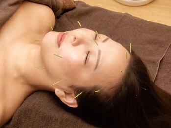 クオーレ(Cuore)/美容鍼灸