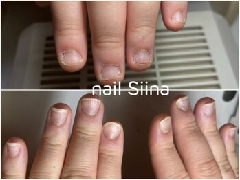 シーナ(Siina)の写真/自爪の形が気に入らない・爪に関する様々なお悩みを抱えていらっしゃるあなたへ、プロにお任せ下さい。