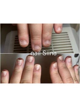 爪の悩みを解消できる（ケア含む）