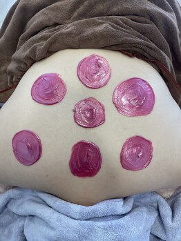 クラティス 塩尻店(CRATIS)/背中美人/背中の産毛除去