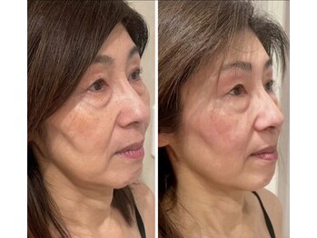 ドクターボディクリスタル(Dr.Body Crystal)/50代