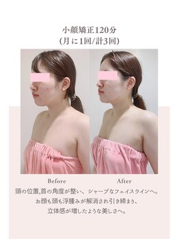 トゥインクル 麻布(twinkle)/麻布十番/南麻布/広尾/小顔矯正