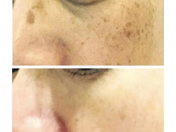 ソワンドゥース ヴェール(Soin douse Vert)/