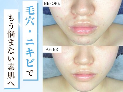 アンドミー 福岡博多店(&me)の写真