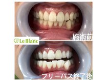 ルブラン 奈良店(Le Blanc)/黄ばみは大敵！！