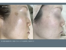 ミレラ(Mirela)の雰囲気(気になるシミ・色ムラをケア!内側から澄み渡るツヤ肌へ*)