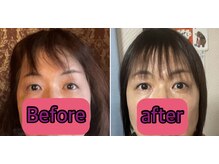 ノウ(nou)/NMN美容液