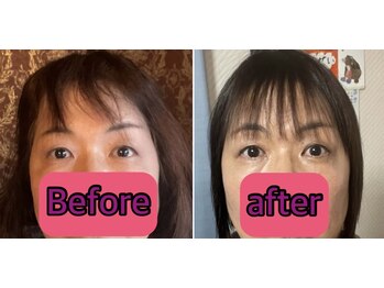 ノウ(nou)/NMN美容液