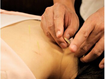 さがみ鍼灸整骨院/鍼灸が初めての方にもオススメ*