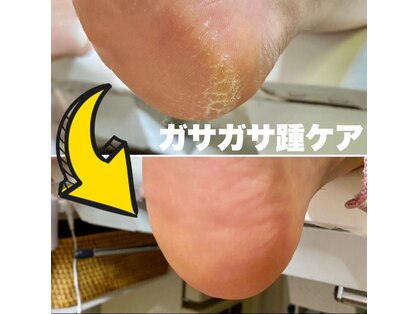 ランカ(RUNKA)の写真