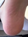 フットケア