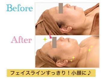 ルフレ(Rufure)/劇的ビフォーアフター♪