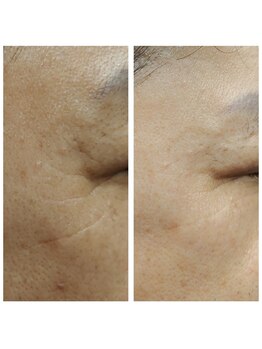 ココスタイルビューティー(COCOSTYLE beauty)/ララピール