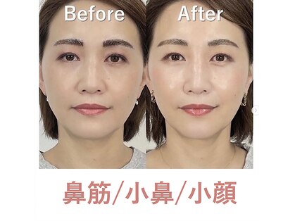 ラプリ 大宮店(Raplit)の写真