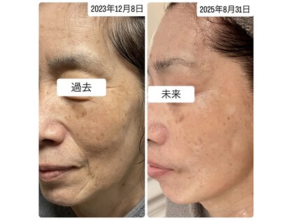 オレア(Olea)の写真