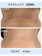 アーヒル 富山店(A”-HILU)/