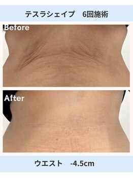 アーヒル 富山店(A”-HILU)/