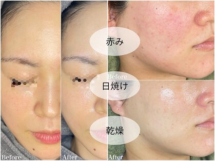 ちらちゅらの写真