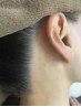 【うなじ脱毛】うなじのみシェービング＆うなじのみ光脱毛のセット　5000円
