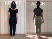 ルア(Lua)/歪み改善＆引き締め効果