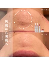 ヴィヴィアン 太田川店(Vivian)/根本から肌質改善！